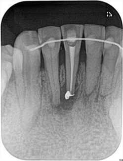 2017.03.18 endo2_R23.jpg